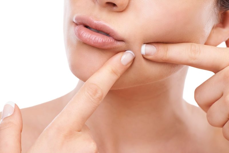 pimple-treatmentuk